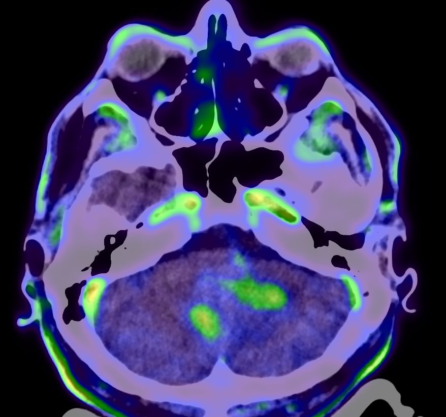 imagen diagnostica 
