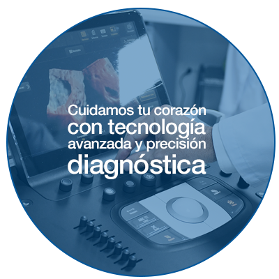 Servicio de Medicina Cardiovascular